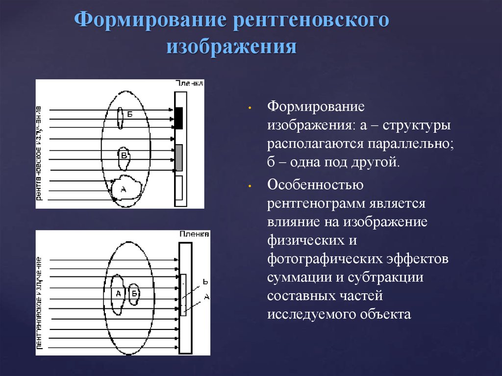 Контраст между деталями рентгеновского изображения главным образом обусловлен