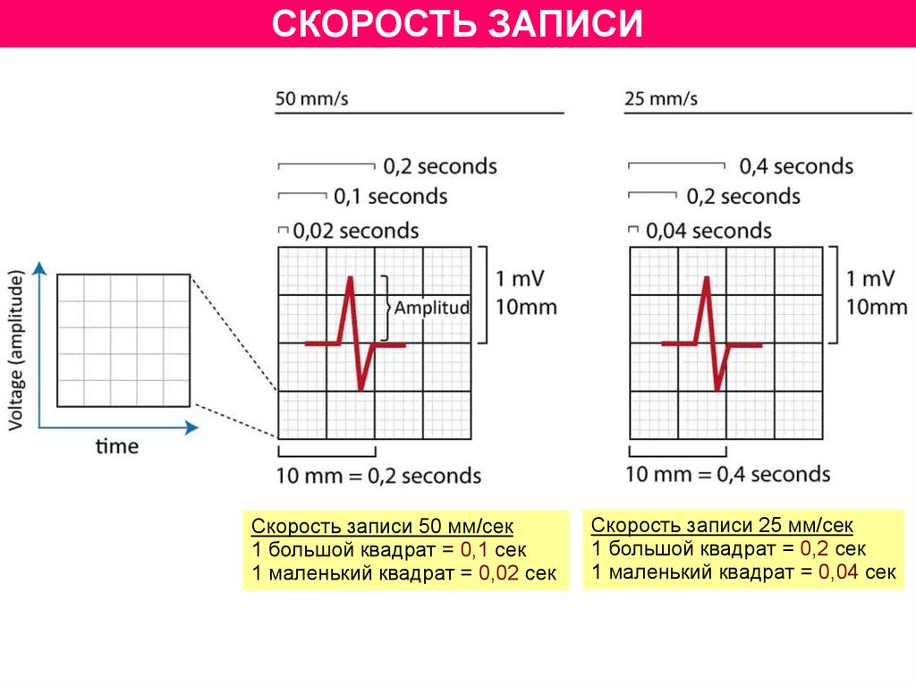 Скорость записи. Скорость на бумаге.