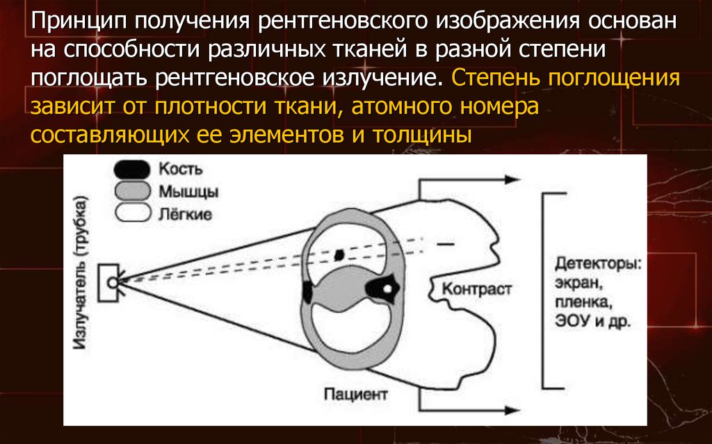 В чем смысл рентгенографии с прямым увеличением рентгеновского изображения