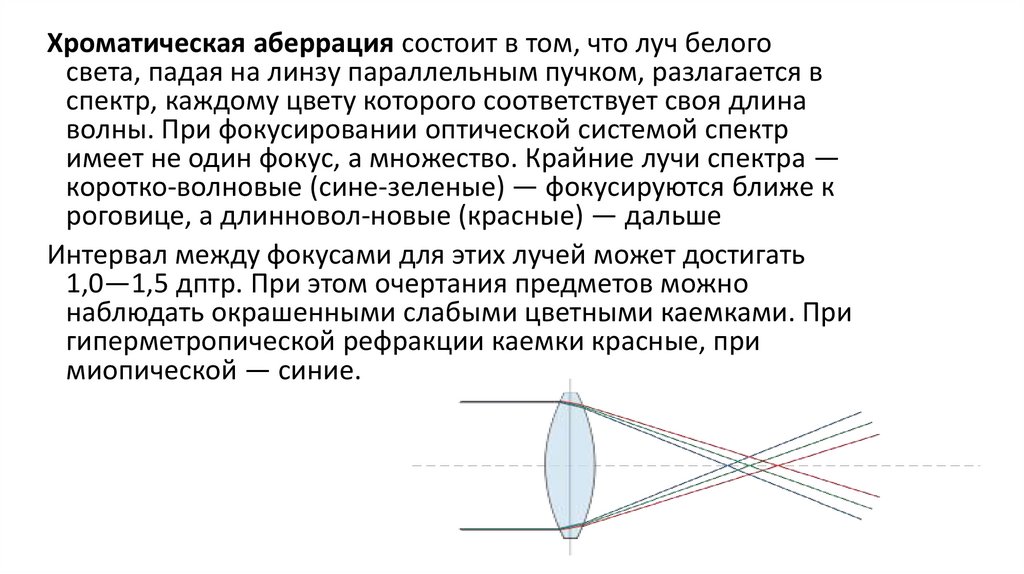 Астигматизм аберрация лечение