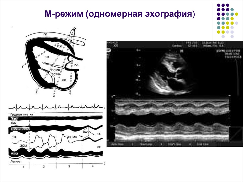 Режим б. Методики ультразвукового исследования a-режим. М-режим ультразвукового исследования. Одномерный метод ультразвукового исследования. Эхография одномерная а метод.