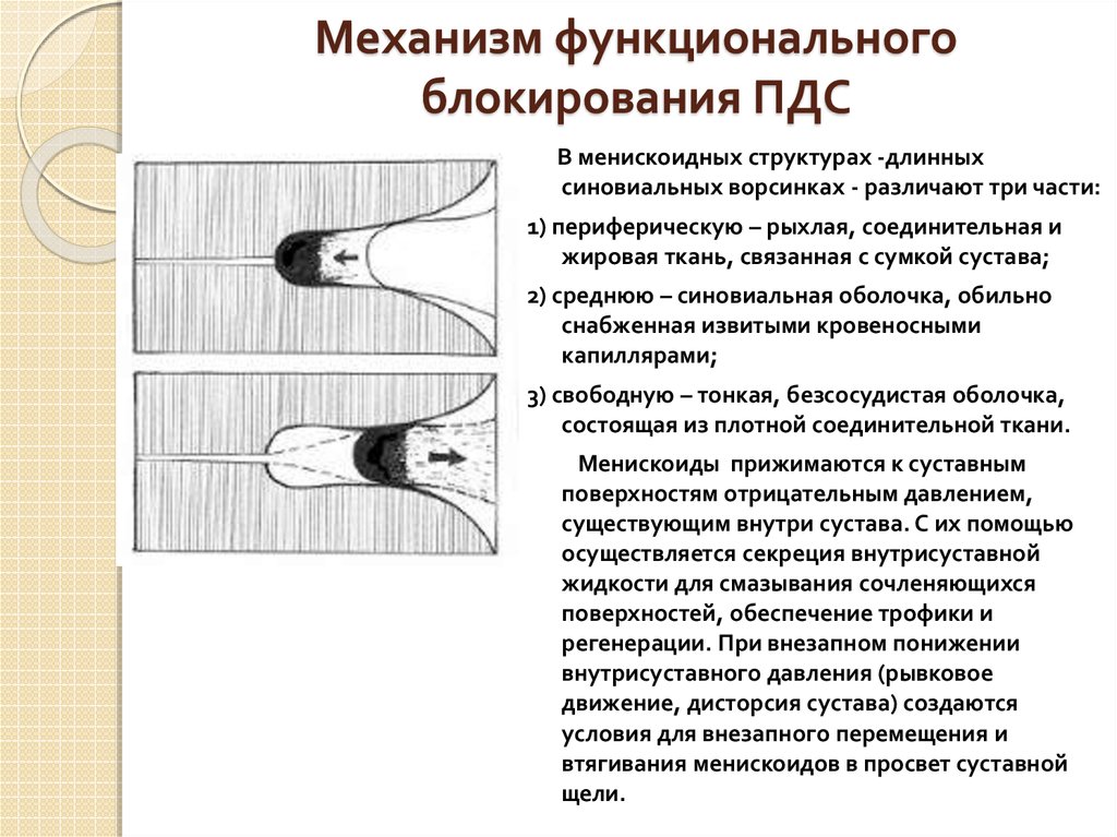 Дисторсия шейного отдела позвоночника