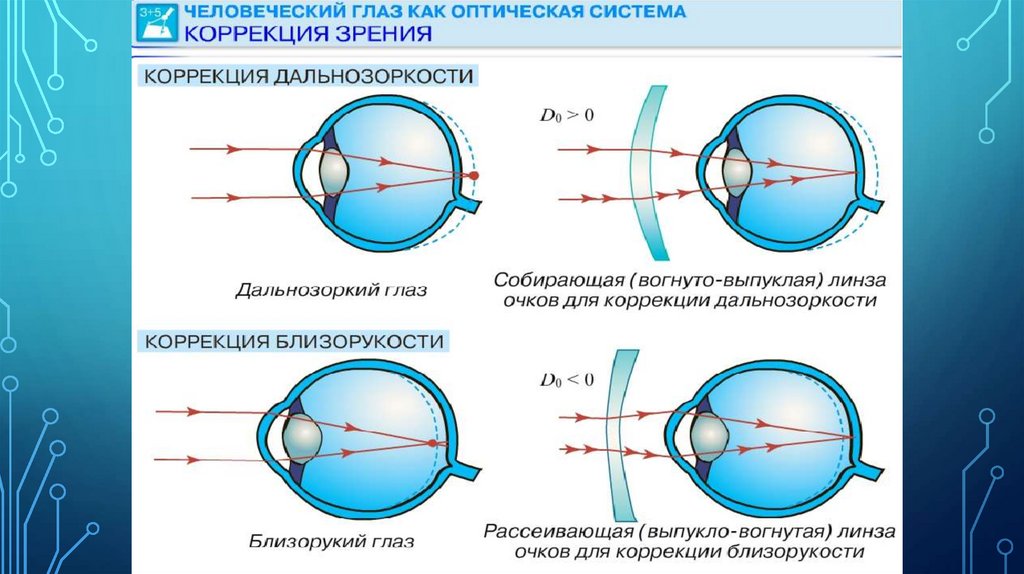 Четкое изображение фокусируется перед сетчаткой это