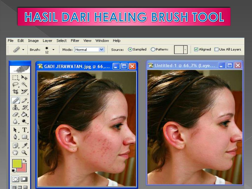 Как восстановить кисть в фотошопе. Хилинг браш в фотошопе. Healing Brush в фотошопе. Spot Healing Brush Tool в фотошопе. Healing Brush Tool в фотошопе.