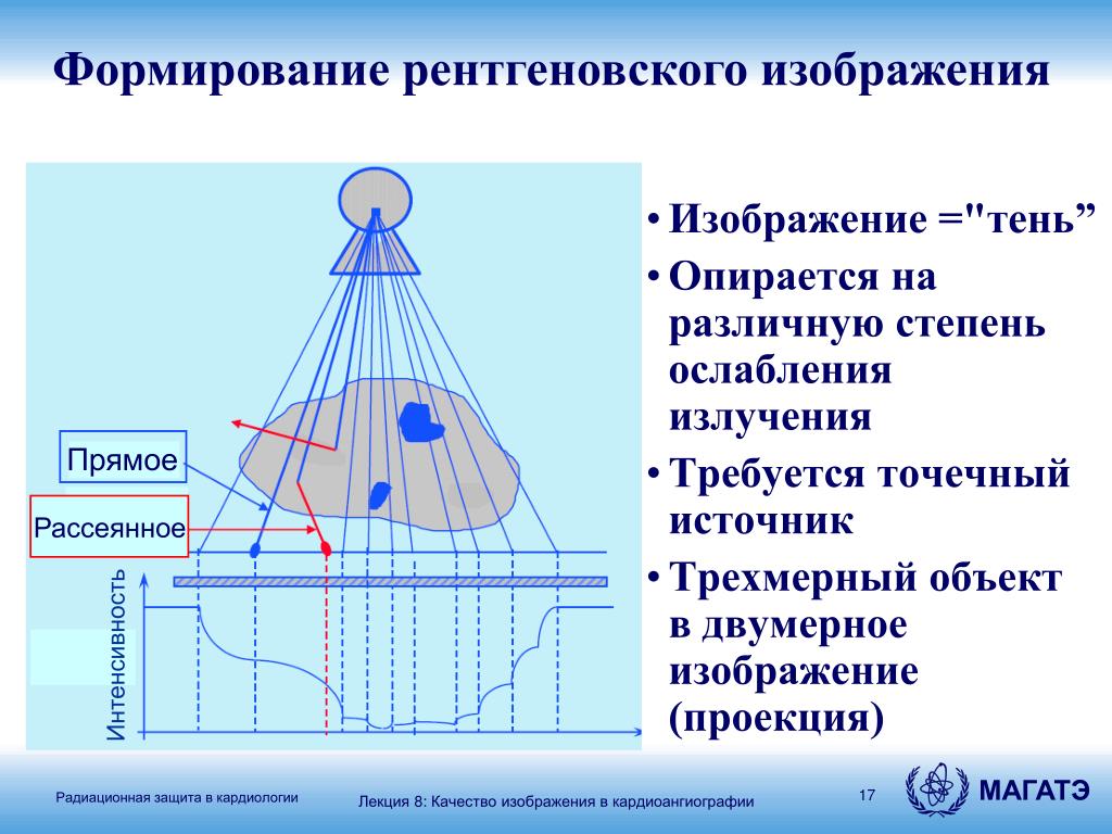 Контраст между деталями рентгеновского изображения главным образом обусловлен