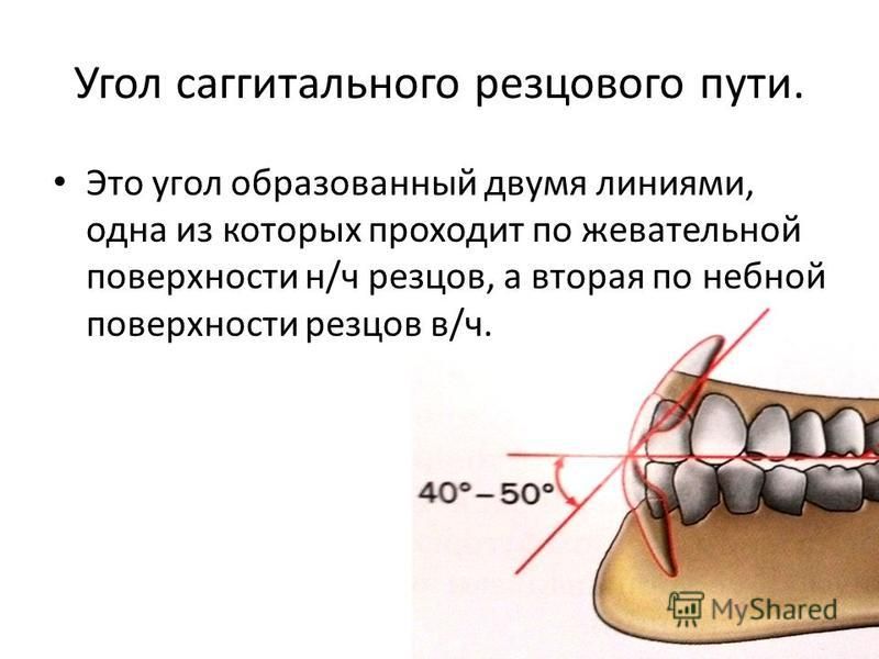 Резцовый