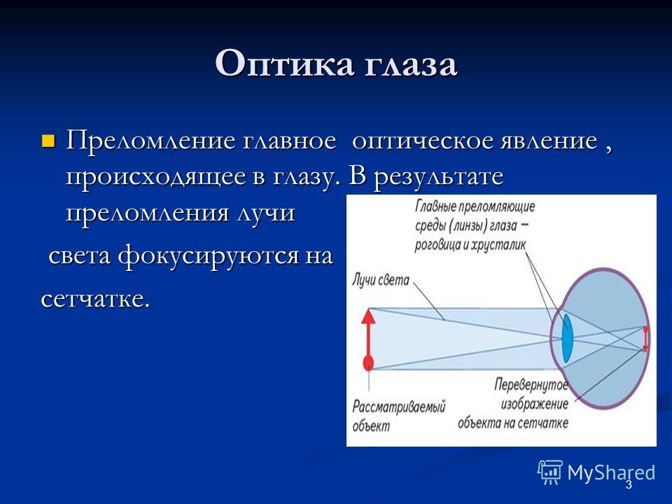 Последовательность оптических структур глаза. Преломление лучей света в оптической системе. Преломление световых лучей в глазу. Преломление света в оптической системе глаза. Преломление лучей света в оптической системе глаза это.