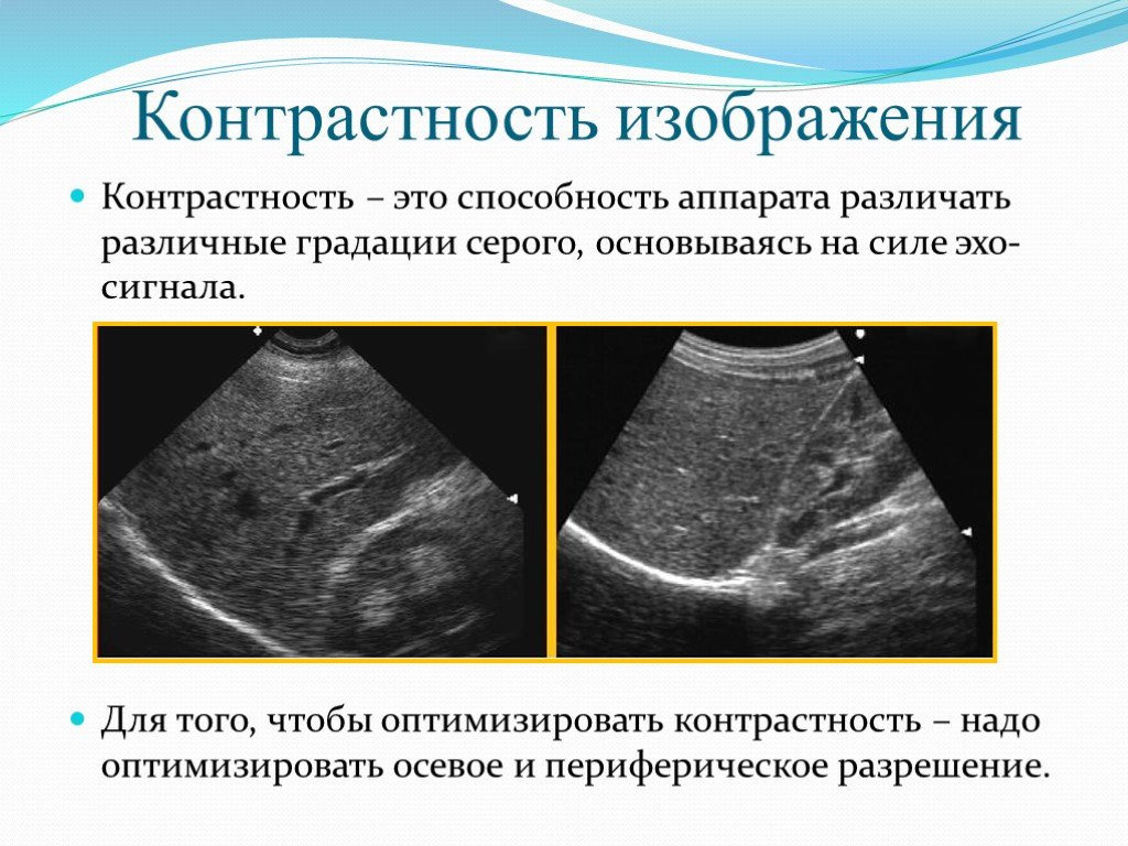 Контрастность это. Контрастность. Контраст изображения. Высококонтрастное изображение. Неконтрастный.