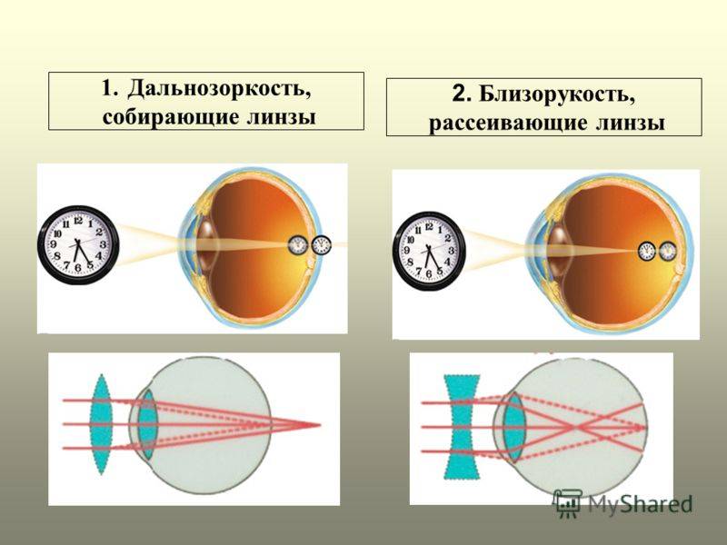 Линзы оптическая сила линзы изображения даваемые линзой глаз и зрение 8 класс