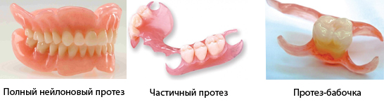 Некоторые виды зубных конструкций
