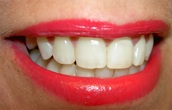 How to Whiten Teeth in Lightroom